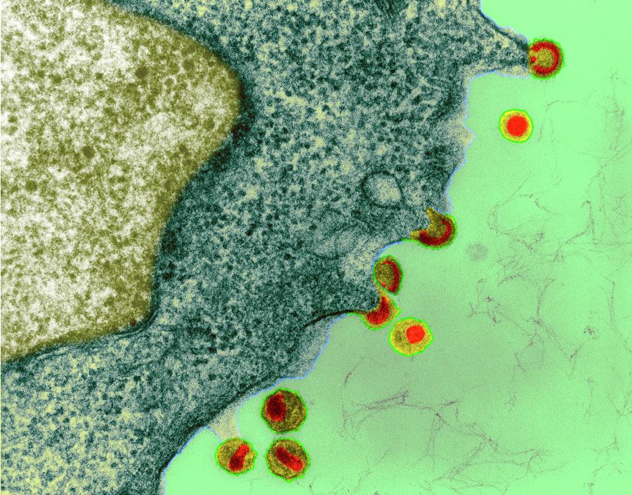 Hiv Infection In Lymph Tissue Photograph by Dennis Kunkel Microscopy ...