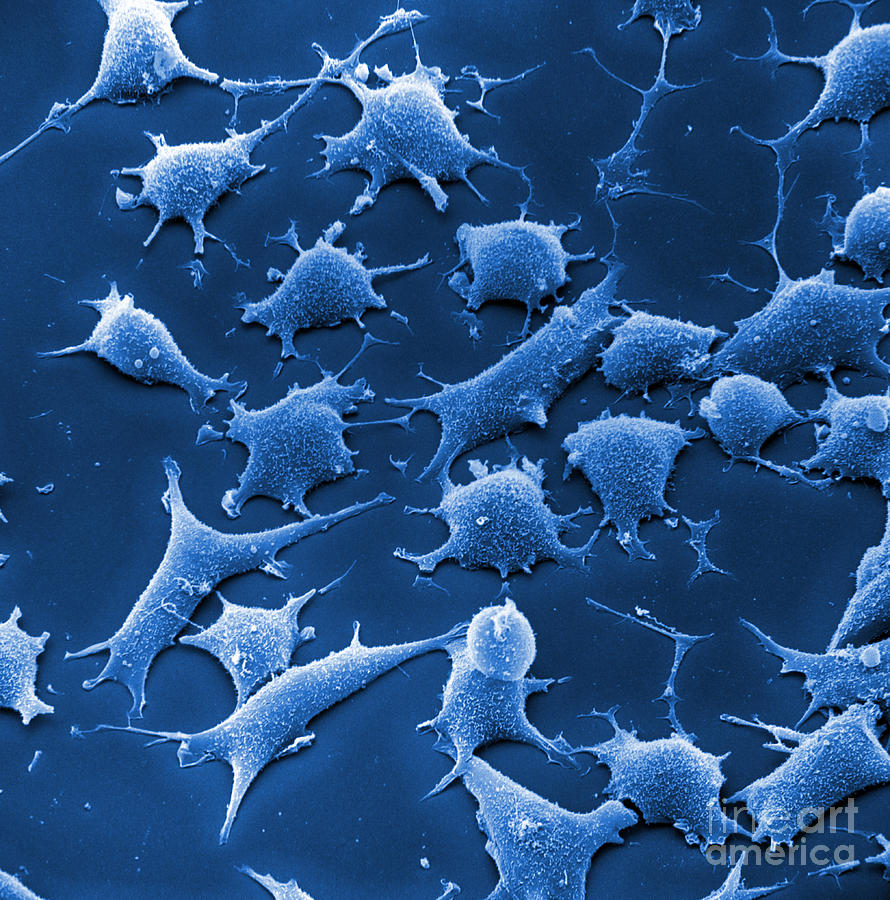 Anatomy Photograph - Human Fibroblast Cells #11 by David M. Phillips