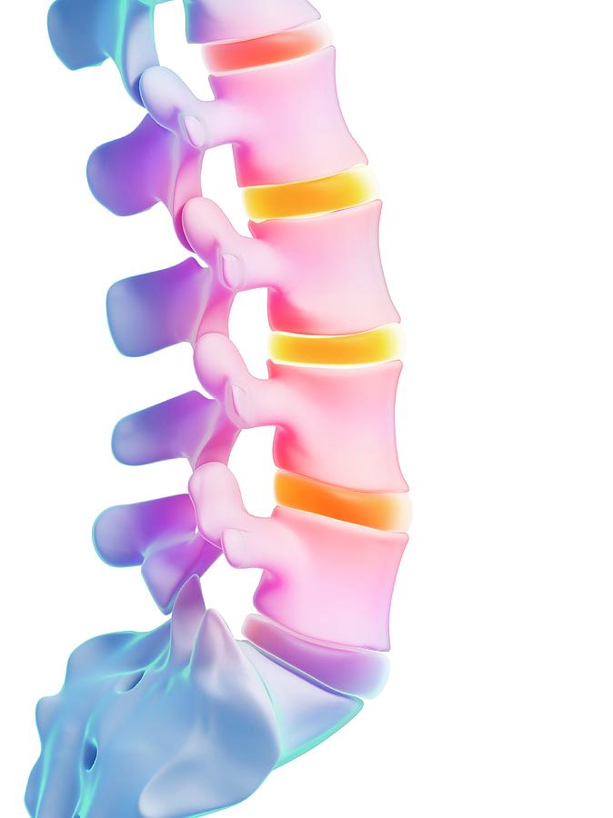 Human Lumbar Spine #11 Photograph by Sebastian Kaulitzki