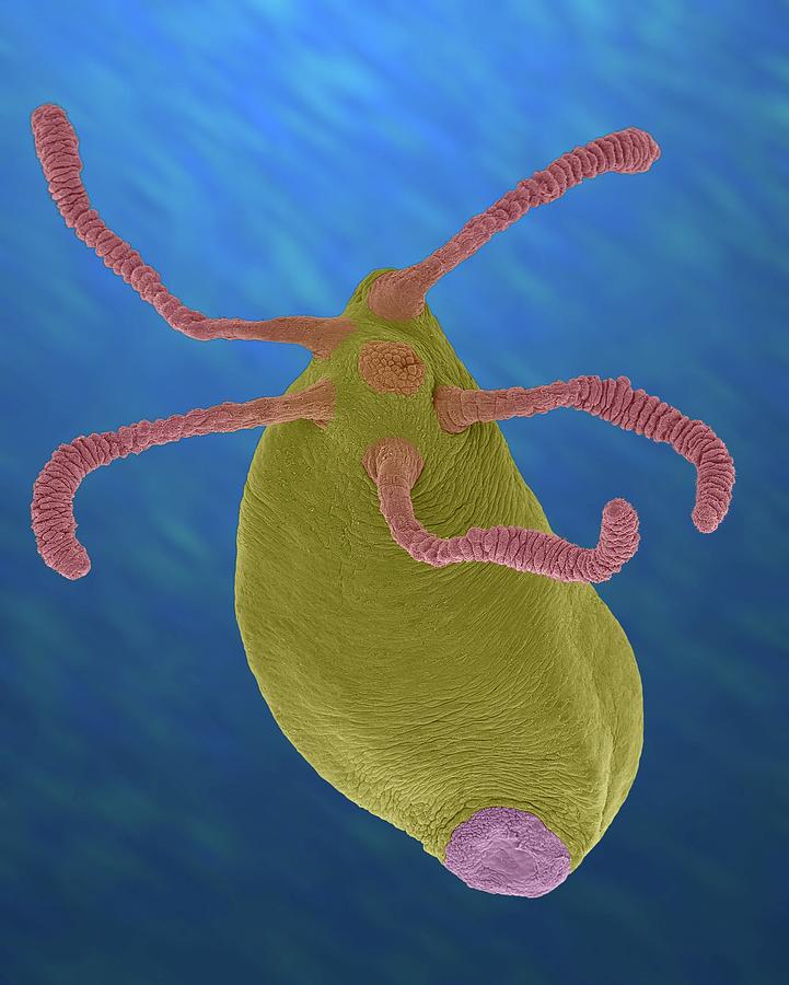 Hydra Sp. (cnidarian) by Dennis Kunkel Microscopy/science Photo Library
