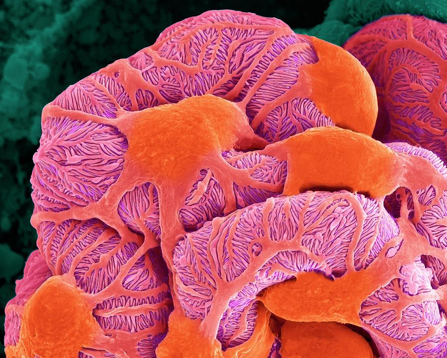 Kidney Glomerulus #11 Photograph by Dennis Kunkel Microscopy/science Photo Library