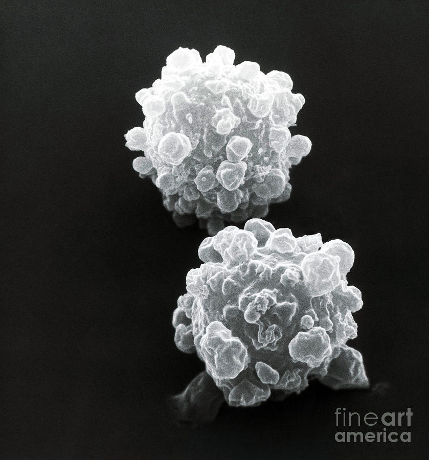 Lymphocytes Undergoing Apoptosis, Sem #11 Photograph by David M. Phillips