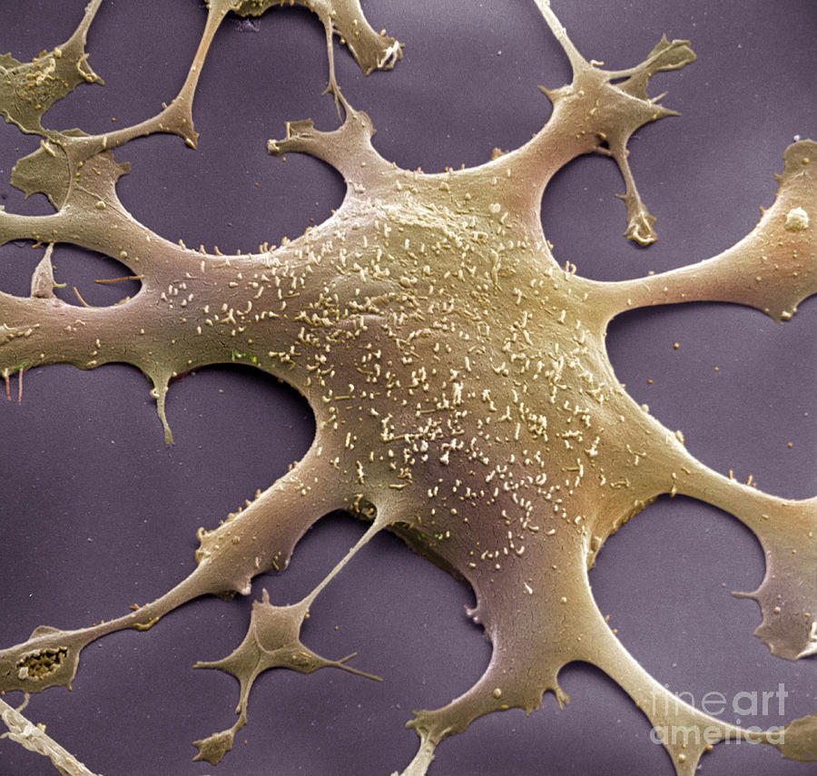 Mycoplasma #11 Photograph by David M. Phillips