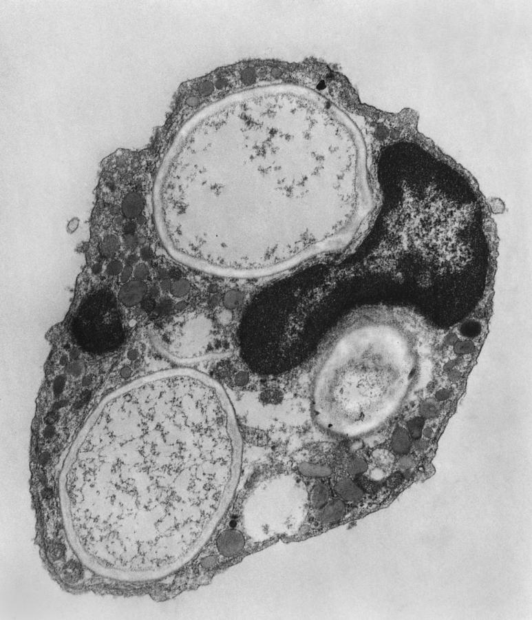 Phagocytosis #11 Photograph by Joseph F. Gennaro Jr.