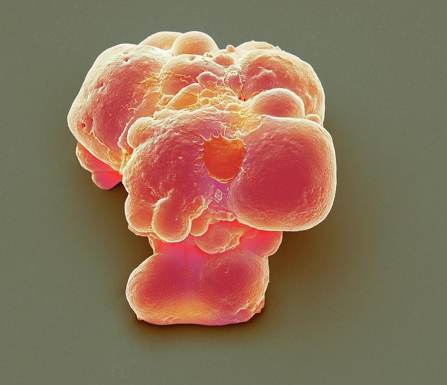 Pluripotent Stem Cells #11 Photograph by Steve Gschmeissner