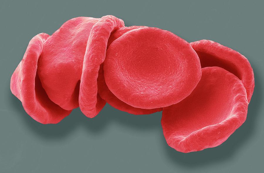 Anatomical Photograph - Red Blood Cells #11 by Steve Gschmeissner