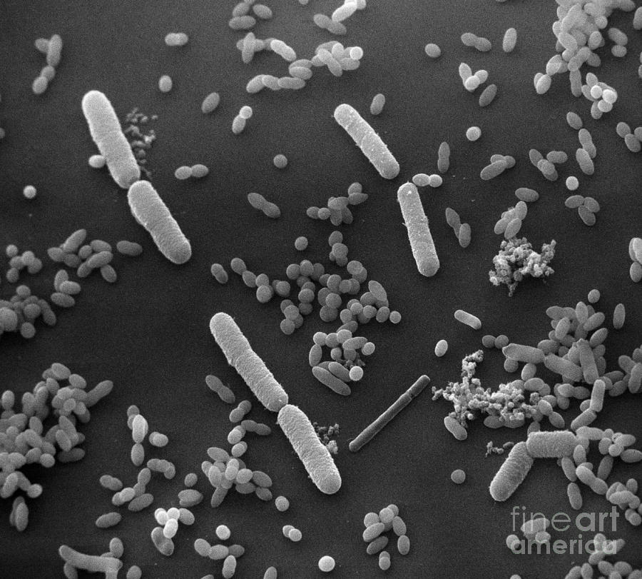 Sem Of Polluted Water #11 Photograph by David M. Phillips