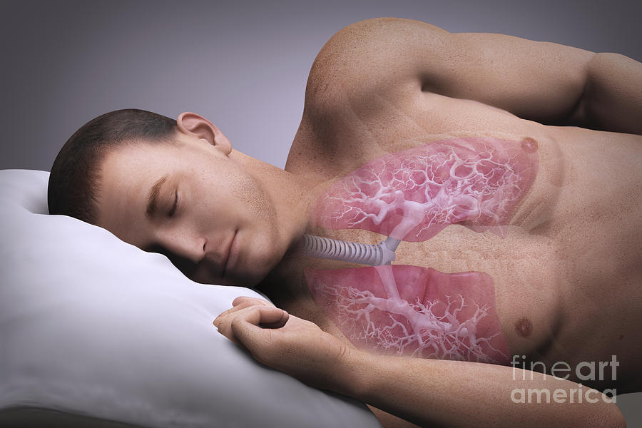 Sleep Apnea #11 Photograph by Science Picture Co