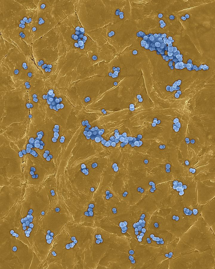 Staphylococcus Aureus On Human Skin Photograph By Dennis Kunkel