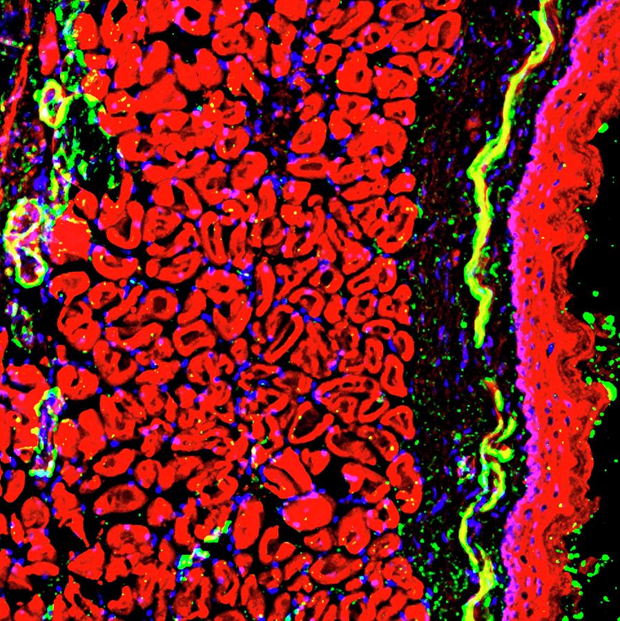 Throat Tissue #11 Photograph by R. Bick, B. Poindexter, Ut Medical School/science Photo Library