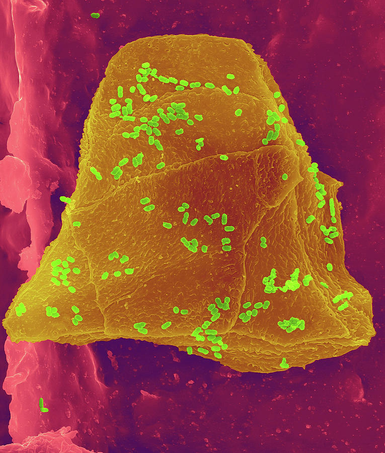 Used Wax Dental Floss #11 Photograph by Dennis Kunkel Microscopy/science Photo Library