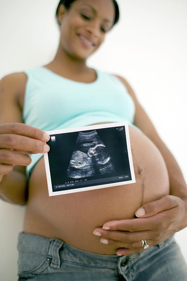 Pregnant Woman #117 Photograph by Ian Hooton/science Photo Library