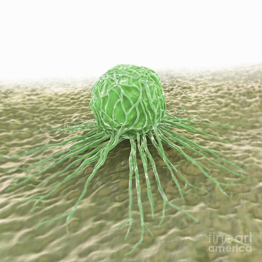 Breast Cancer Cell #11 Photograph by Science Picture Co
