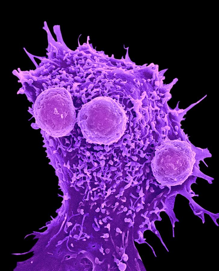 Cancer Cell And T Lymphocytes #12 Photograph by Steve Gschmeissner