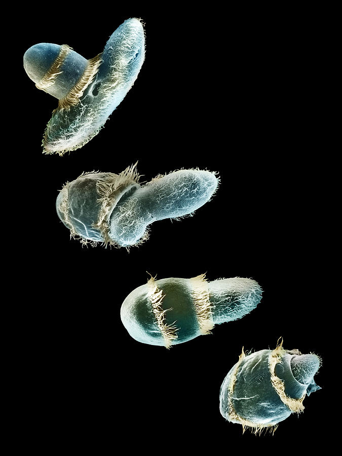 Didinium Ingesting Paramecium #12 Photograph by Greg Antipa