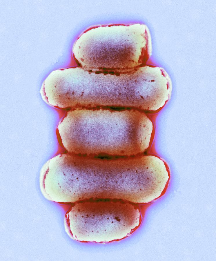 E Coli Bacteria Photograph By Centre For Infections Public Health   12 E Coli Bacteria Centre For Infectionspublic Health Englandscience Photo Library 