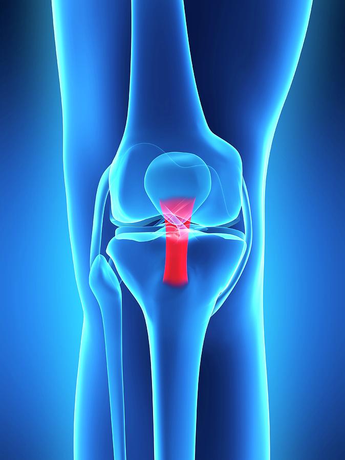 Human Knee Anatomy #12 Photograph by Sebastian Kaulitzki