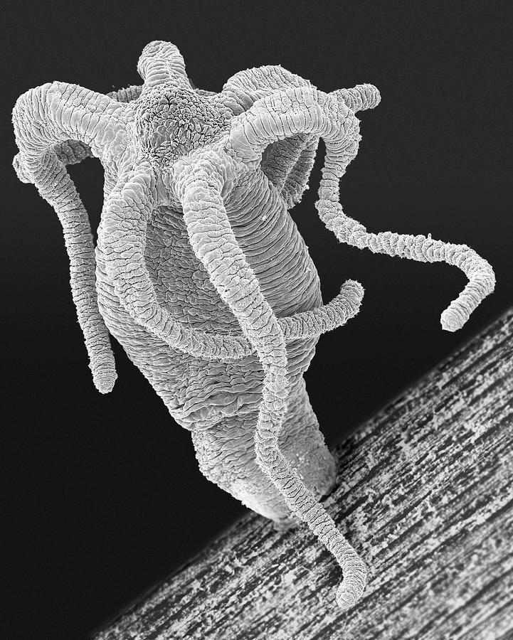 Hydra Sp. (cnidarian) #12 Photograph by Dennis Kunkel Microscopy/science Photo Library