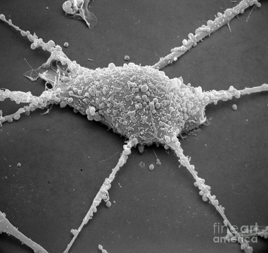 Mycoplasma #12 Photograph by David M. Phillips