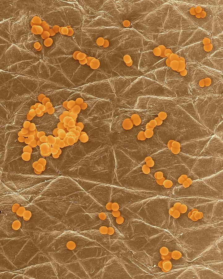 Staphylococcus Aureus On Human Skin #12 Photograph by Dennis Kunkel ...