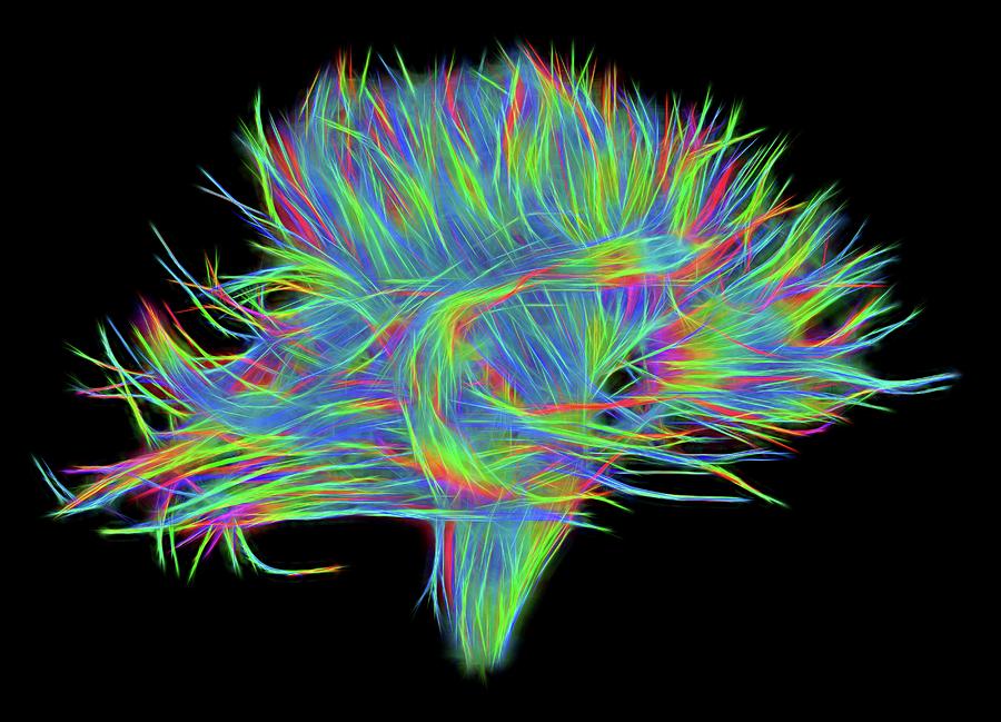 Black Background Photograph - White Matter Fibres Of The Human Brain #12 by Alfred Pasieka/science Photo Library