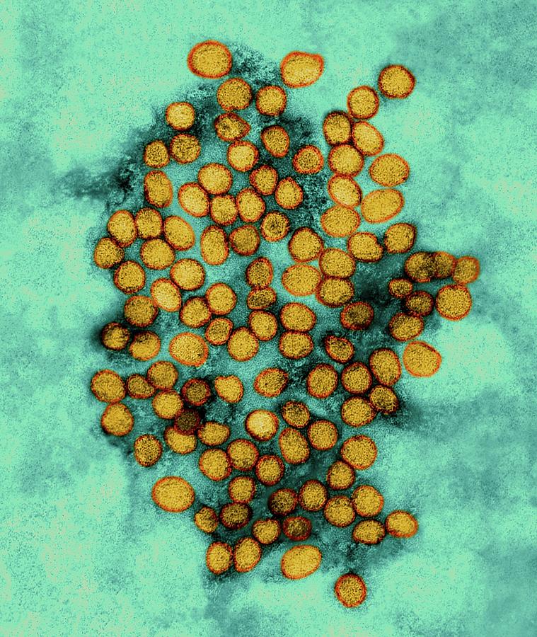 yellow-fever-virus-photograph-by-dennis-kunkel-microscopy-science-photo