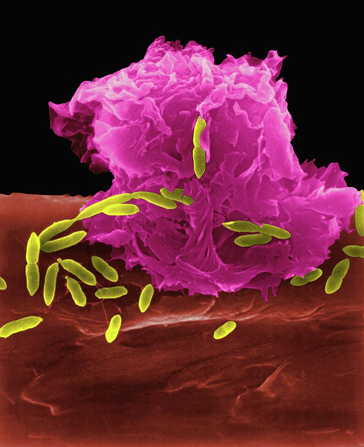 Alveolar Macrophage Phagocytosis Of E Coli Photograph By Dennis Kunkel Microscopyscience Photo 4450