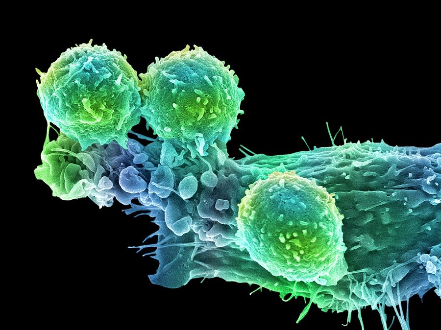 Cancer Cell And T Lymphocytes #13 Photograph by Steve Gschmeissner