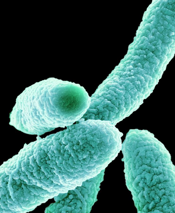 Escherichia Coli Photograph - E. Coli Bacteria #13 by Science Photo Library