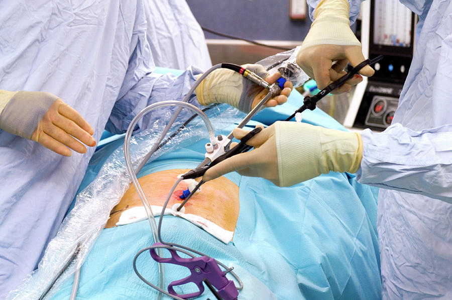 hernia-operation-photograph-by-mark-thomas-science-photo-library-pixels