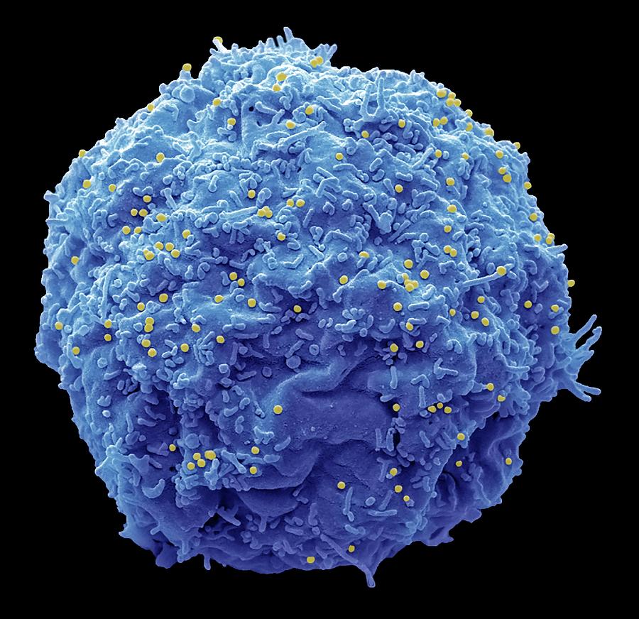 Aids Photograph - Hiv Infected Cell #13 by Steve Gschmeissner/science Photo Library