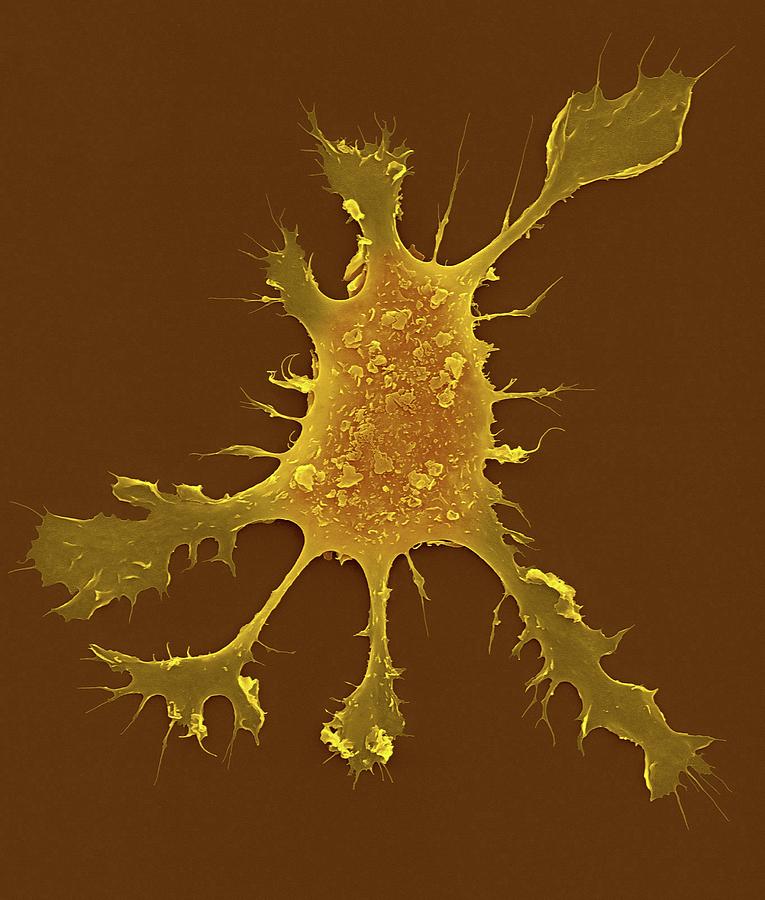 Abnormal Photograph - Human Dendritic Cell #13 by Dennis Kunkel Microscopy/science Photo Library
