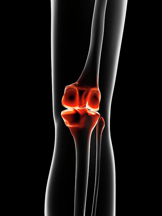 Human Knee Pain Photograph by Sebastian Kaulitzki