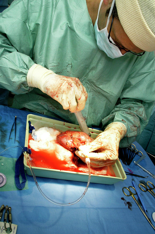 Kidney Transplant #13 Photograph by Aj Photo/science Photo Library