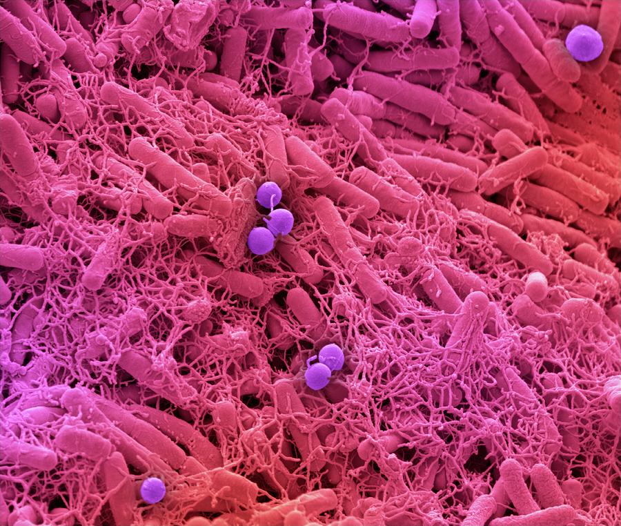 Microbiome #13 Photograph by Steve Gschmeissner/science Photo Library ...