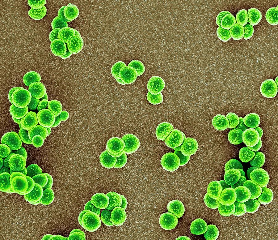 Staphylococcus Aureus Photograph - Mrsa Bacteria #13 by Science Photo Library