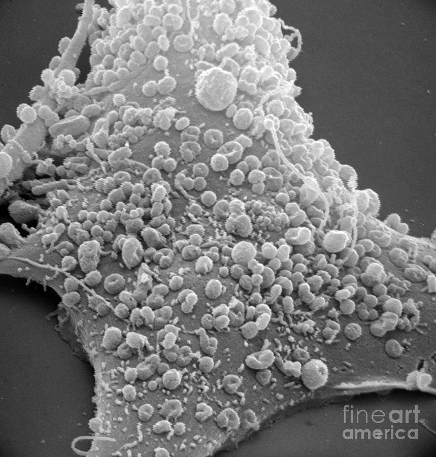 Mycoplasma #13 Photograph by David M. Phillips