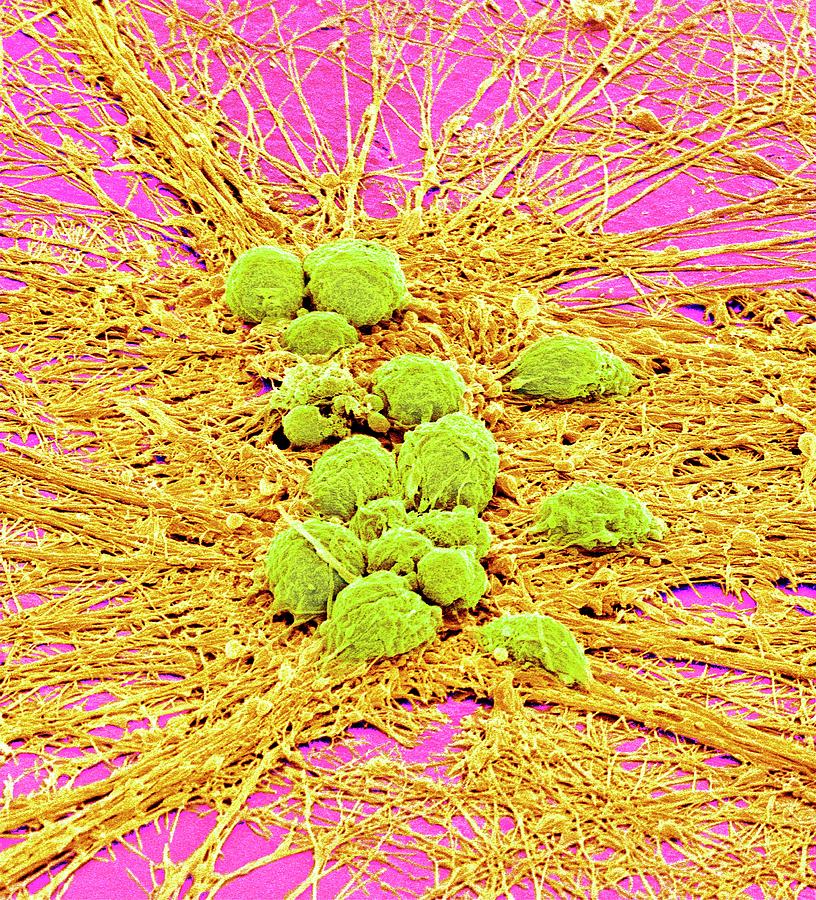 Nervous System Cells #13 Photograph by Susumu Nishinaga