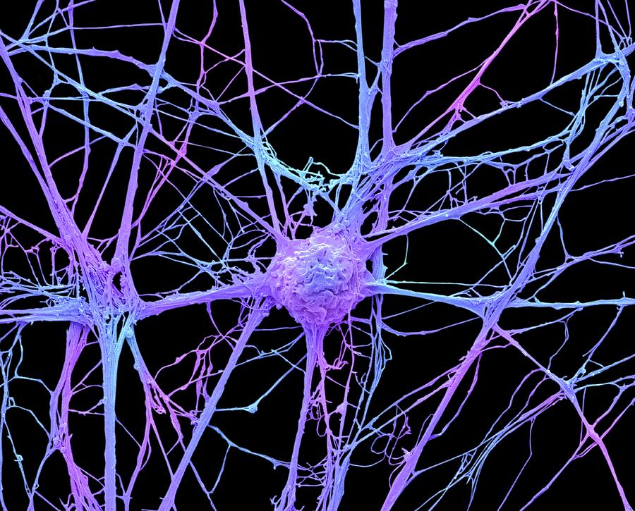 Neurone #13 Photograph by Steve Gschmeissner
