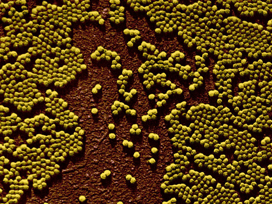Polio Virus, Tem #13 Photograph by Omikron