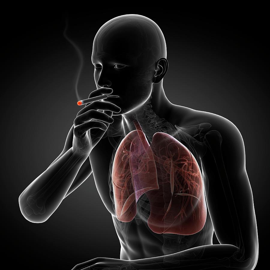 Smoker #13 Photograph by Sciepro/science Photo Library - Pixels