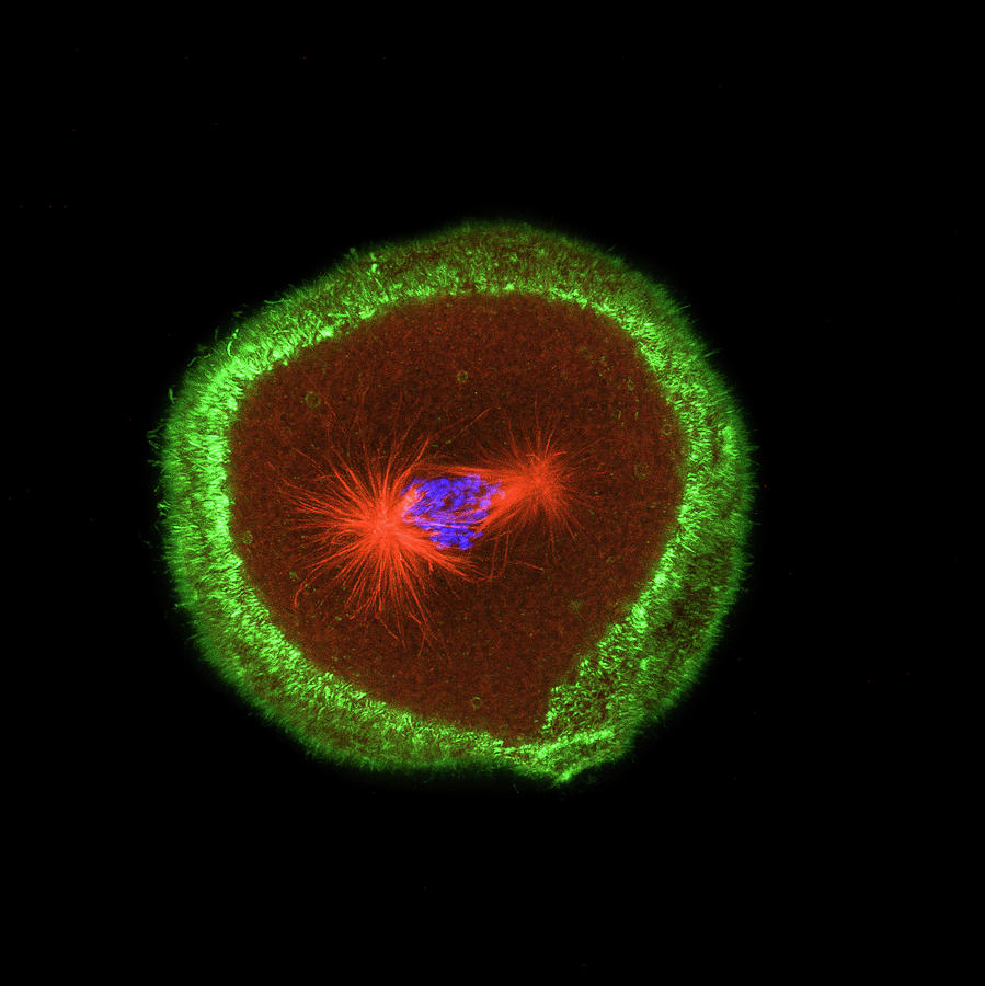 Sea Urchin Cell Dividing Photograph by Teresa Zgoda