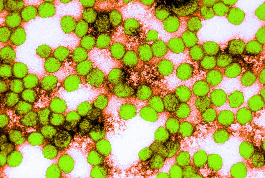 Yellow Fever Virus, Tem #13 Photograph by Science Source