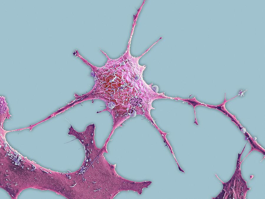 Breast Cancer Cell #14 Photograph by Science Photo Library