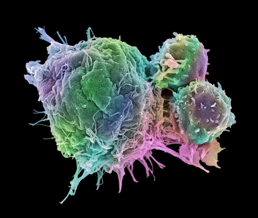 Cancer Cell And T Lymphocytes #14 Photograph by Steve Gschmeissner
