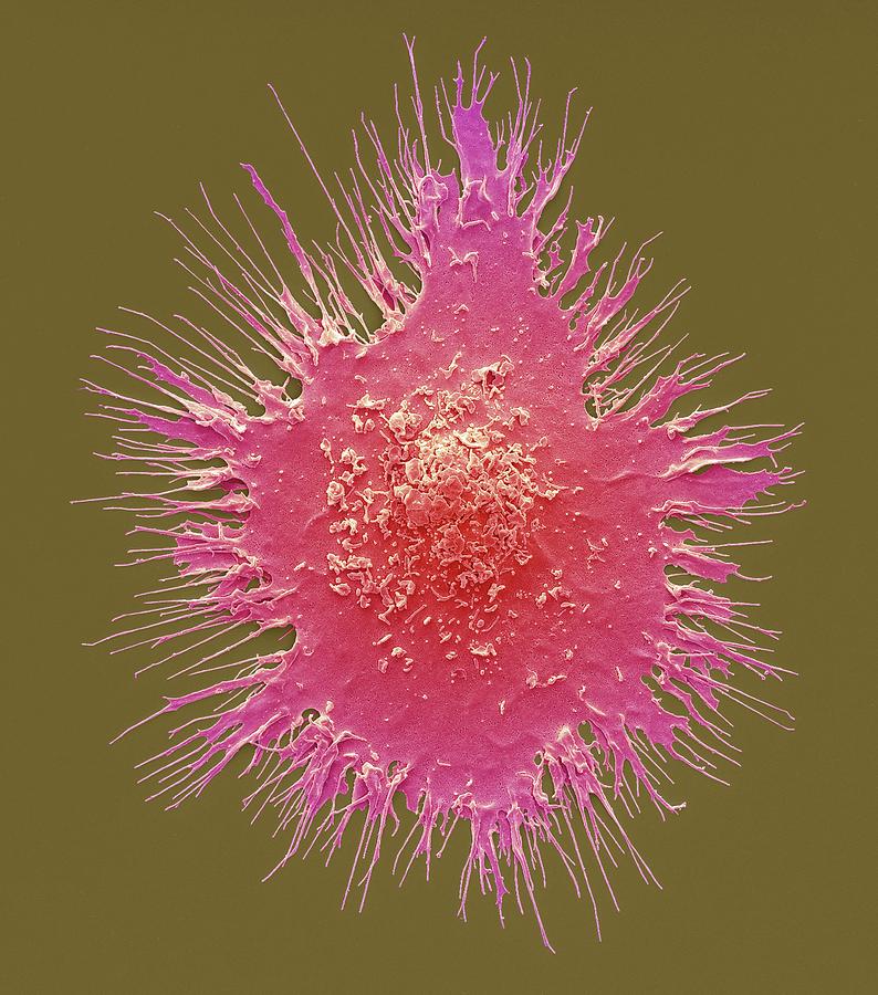 Dendritic Cell #14 Photograph by Steve Gschmeissner