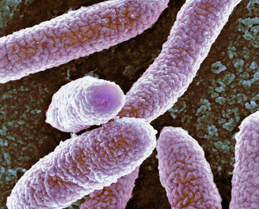 Escherichia Coli Photograph - E Coli Bacteria #14 by Science Photo Library