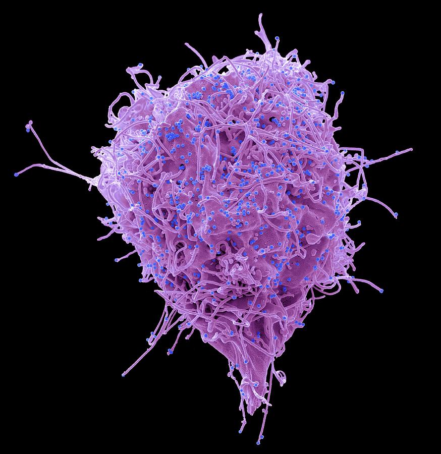 Hiv Infected Cell #14 Photograph by Steve Gschmeissner/science Photo Library