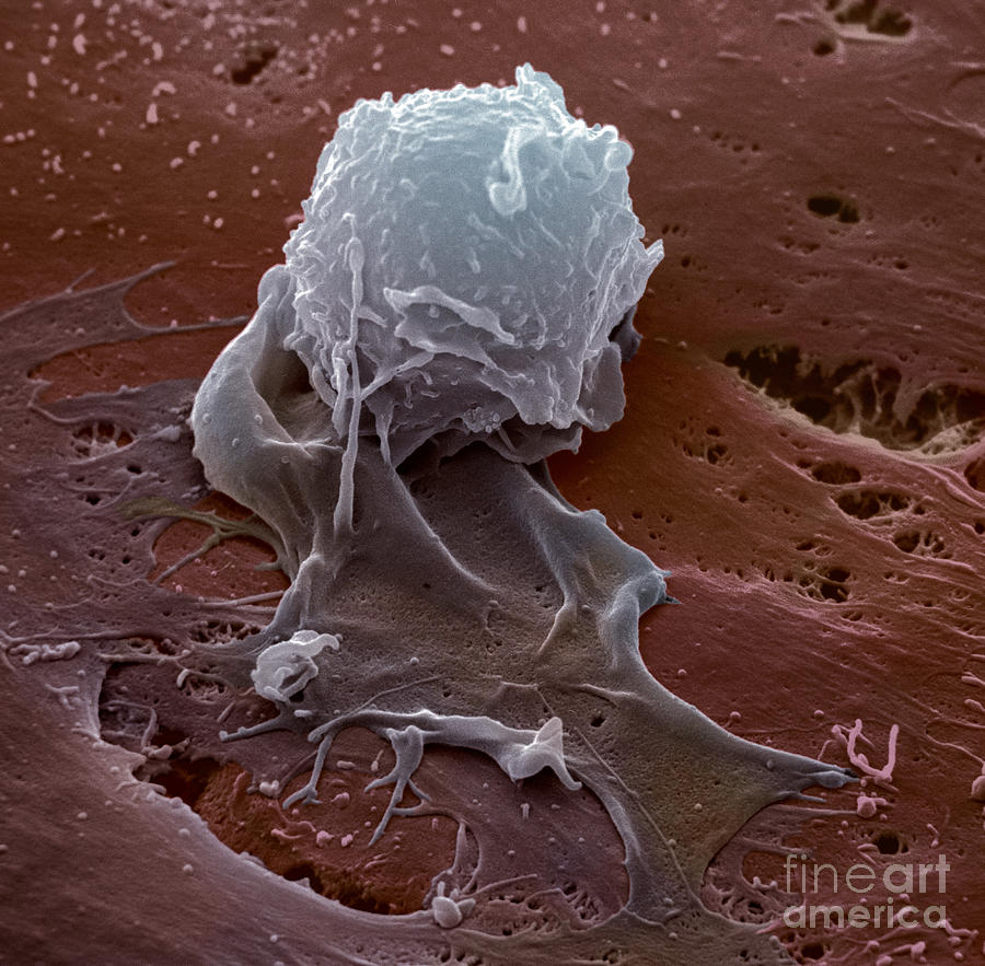 Human Macrophage #14 Photograph by David M. Phillips