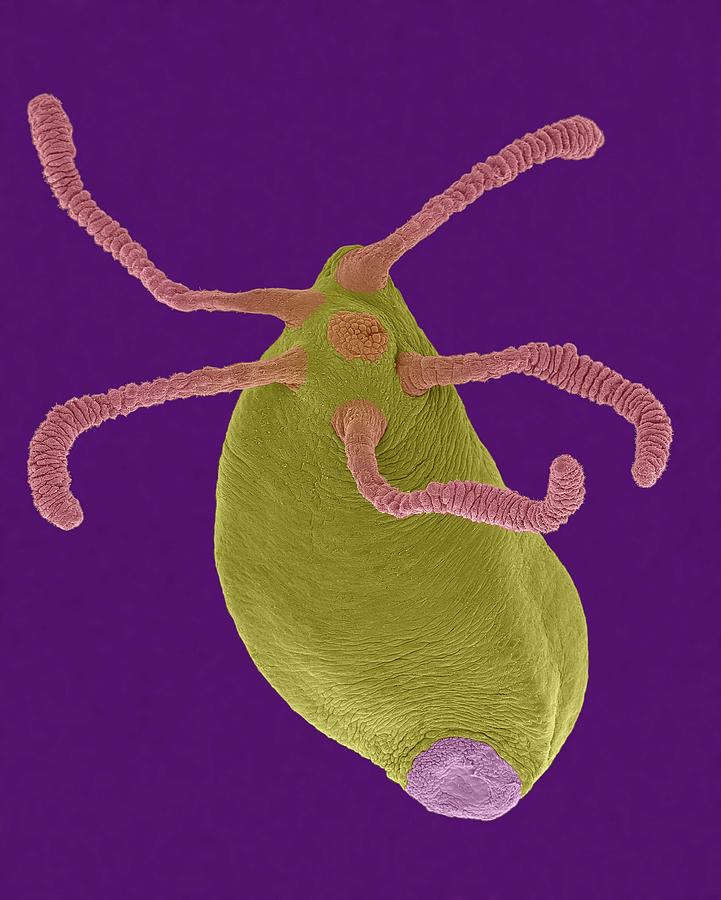 Invertebrate Photograph - Hydra Sp. (cnidarian) #14 by Dennis Kunkel Microscopy/science Photo Library